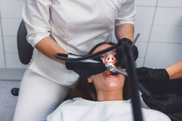 Best Emergency Tooth Extraction in Union City, CA