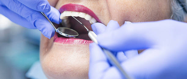 Best After-Hours Emergency Dentist in Union City, CA